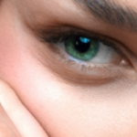 Ανόρθωση φρυδιών